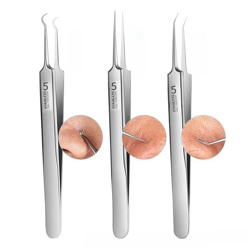 Precision Blackhead Tweezers